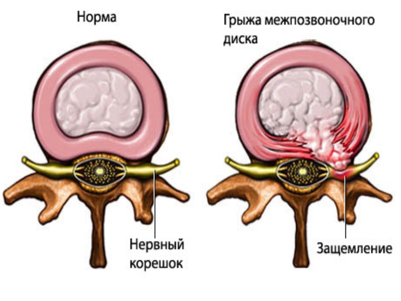 болит шея сзади / почему болит шея сзади